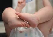 Herbal Remedies For Diaper Rash